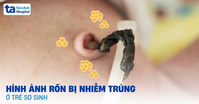 Hình ảnh minh họa cách đo cân nặng cho trẻ sơ sinh tại nhà hoặc phòng khám